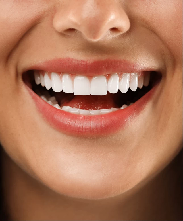 Behandelingen Mondhygiënist Leidsche Rijn