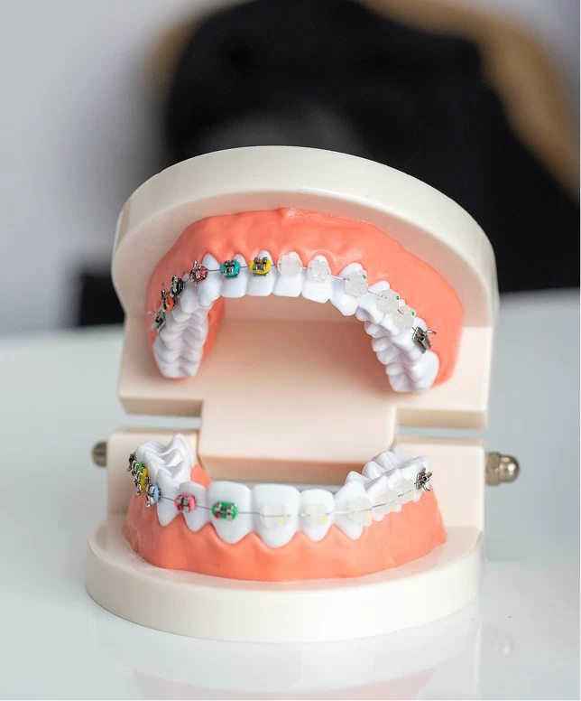 Mondverzorging Beugels Leidsche Rijn